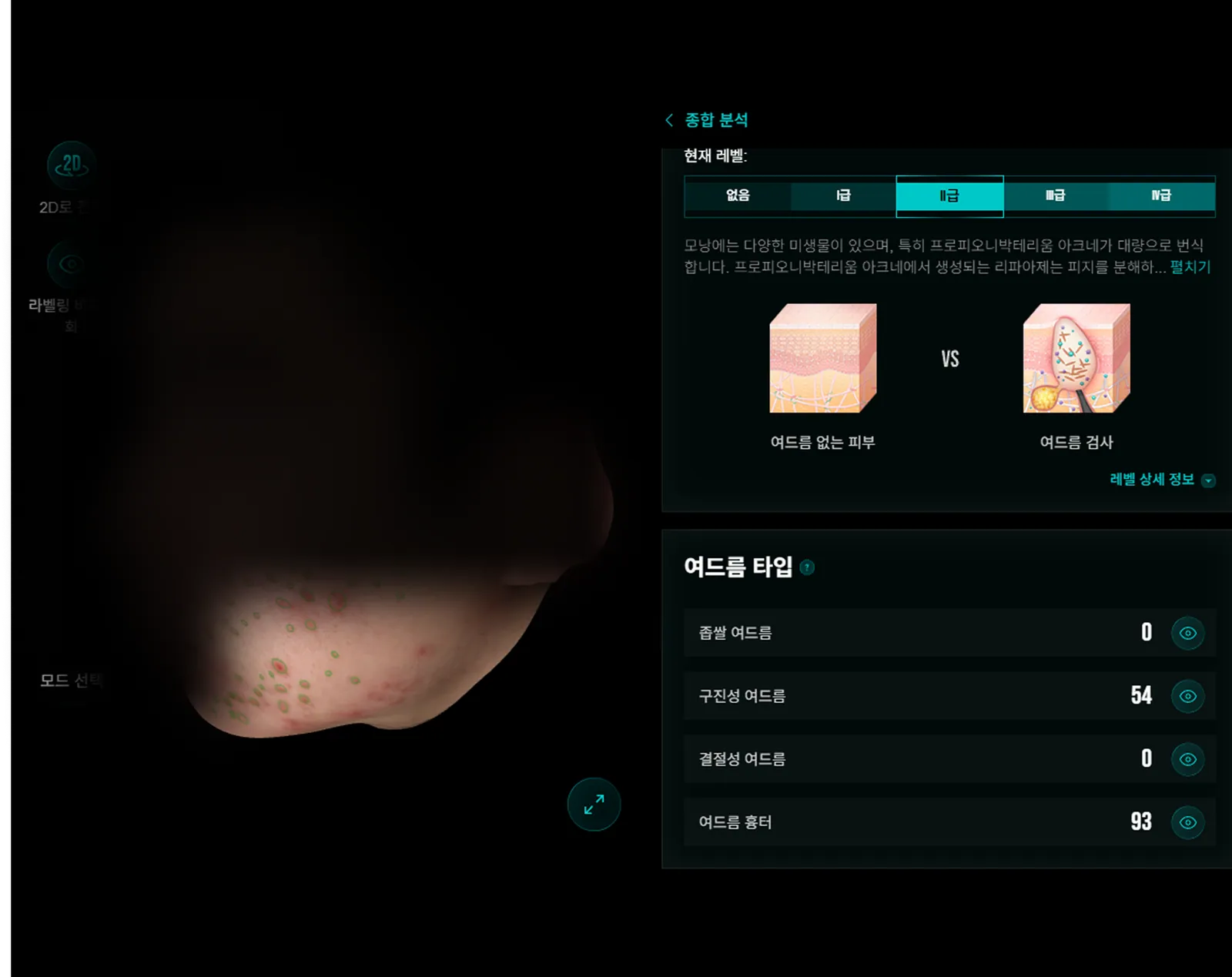 การวิเคราะห์ผิวด้วย AI