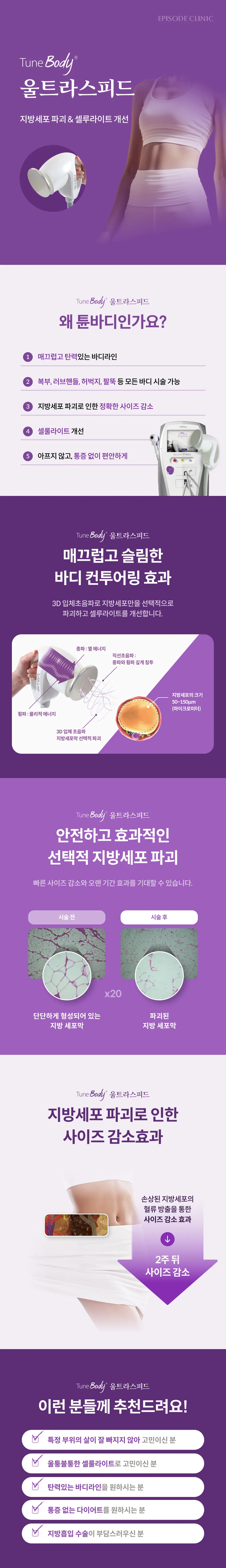 คู่มือการใช้งาน TuneBody UltraSpeed ฉบับละเอียด: การทำลายเซลล์ไขมันและการจัดการเซลลูไลท์, 5 เหตุผลที่ควรเลือก TuneBody, อุปกรณ์ Alma Accent Prime, แผนภาพหลักการทำงานของอัลตราซาวนด์ 3 มิติ, ภาพเนื้อเยื่อก่อนและหลังการรักษาของเยื่อหุ้มเซลล์ไขมัน, กระบวนการลดขนาด, คู่มือการพิจารณาคุณสมบัติ