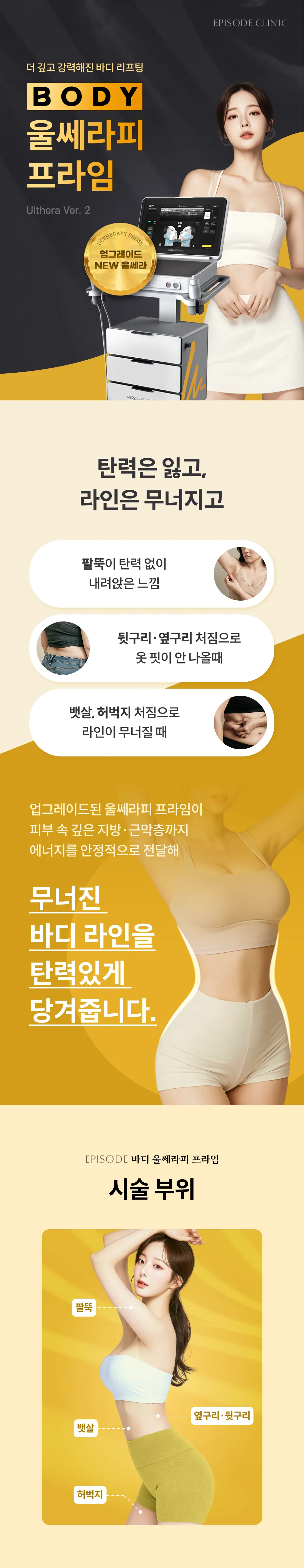 คู่มือฉบับละเอียดสำหรับเครื่อง Ulthera Prime สำหรับผิวกาย: การอัปเกรด Ulthera เวอร์ชัน 2, บริเวณที่ต้องการรักษา (ต้นแขน, สะโพกและข้างลำตัว, ไขมันหน้าท้อง และต้นขาหย่อนคล้อย), ภาพประกอบบริเวณที่ทำการรักษา (ต้นแขน, สะโพกและข้างลำตัว, ไขมันหน้าท้อง, ต้นขา)