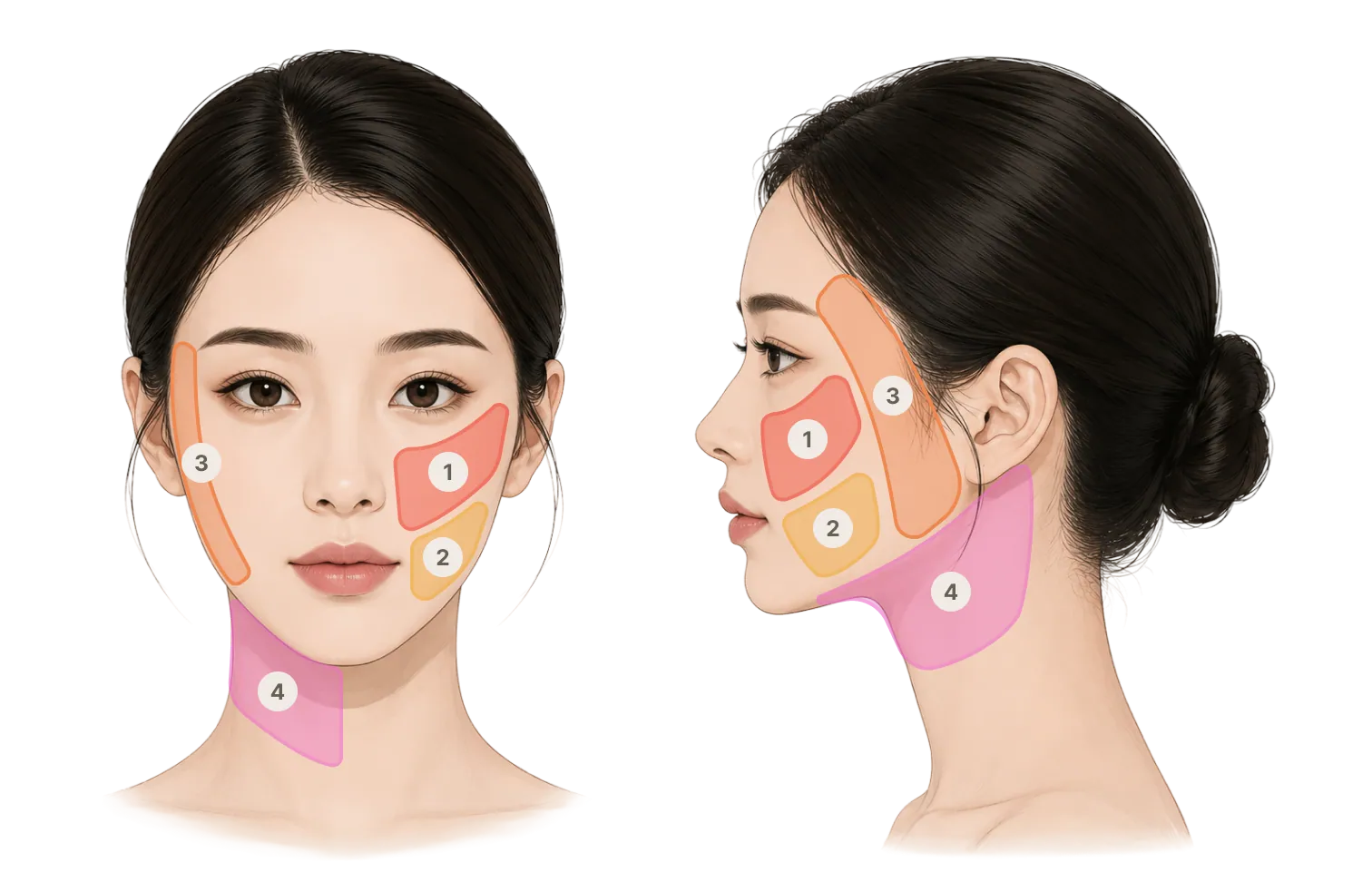 บริเวณที่ทำการรักษาด้วยไหมขัดฟัน